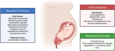 Breaking Down the Barrier: The Role of Cervical Infection and Inflammation in Preterm Birth